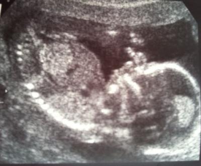 Bild zu Fotos - Forum für August - Mamis