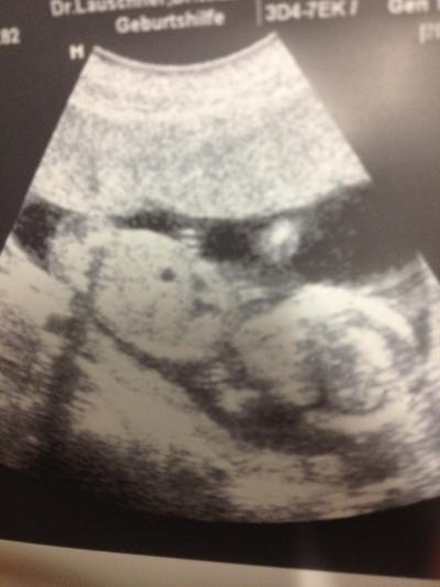 Bild zu Zurück vom FA und Bild im Gepäck :-) - Forum für August - Mamis