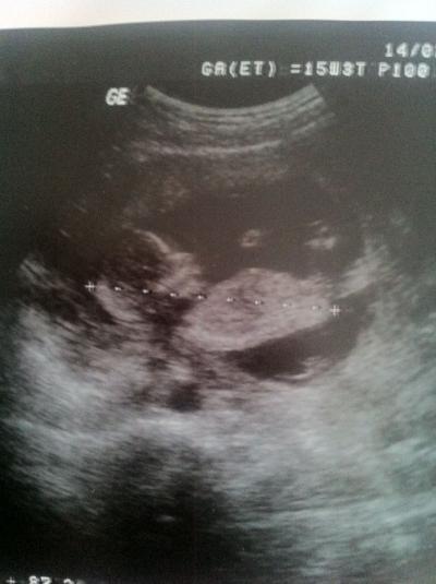 Bild zu Versprochenes Bildchen von gestern... - Forum für August - Mamis