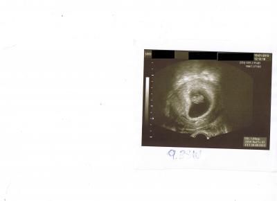 Bild zu FA- Bericht - Forum für August - Mamis