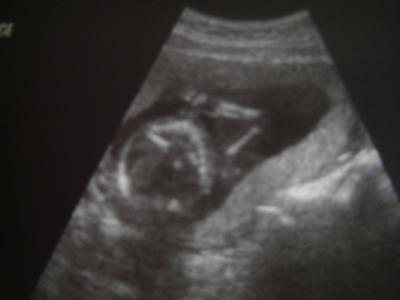 Bild zu Zurück vom Fa - Forum für August - Mamis