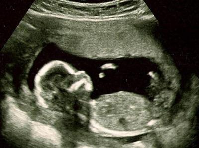 Bild zu FA Termin von gestern - Forum für August - Mamis