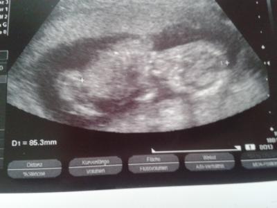 Bild zu Bild von gestern - Forum für August - Mamis