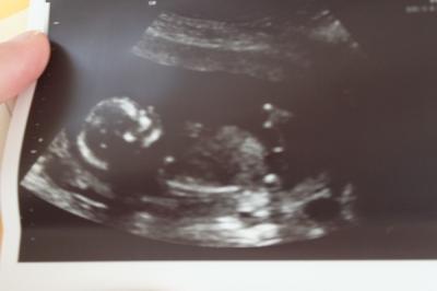 Bild zu mein FA termin gestern - Forum für August - Mamis