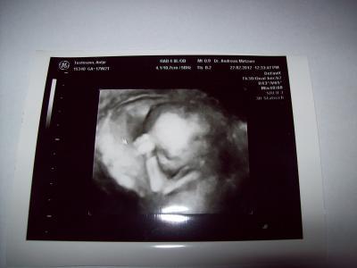 Bild zu Endlich Outing wir bekommen.................. - Forum für August - Mamis