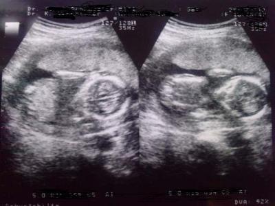 Bild zu Heutiger FA Termin - Forum für August - Mamis