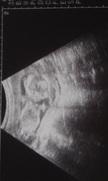 Bild zu wieder zurück... - Forum für August - Mamis