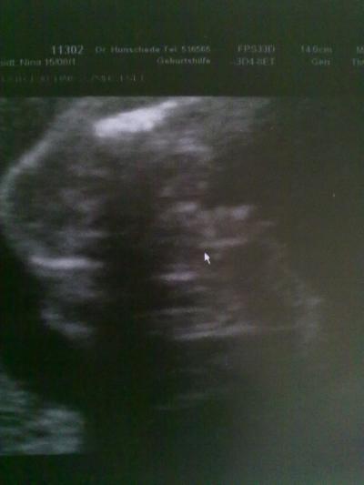 Bild zu was meint ihr..?? - Forum für August - Mamis