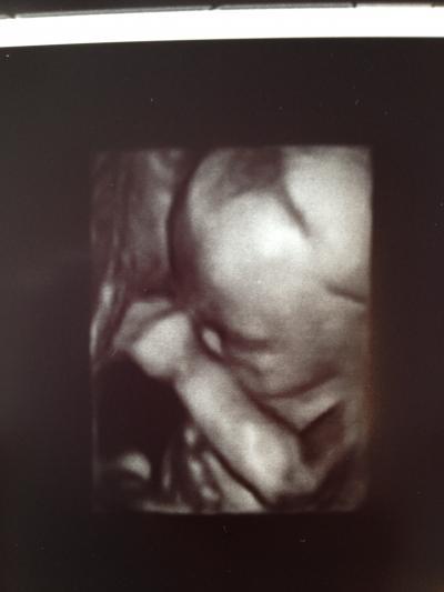 Bild zu Zurück von der FD - Forum für August - Mamis