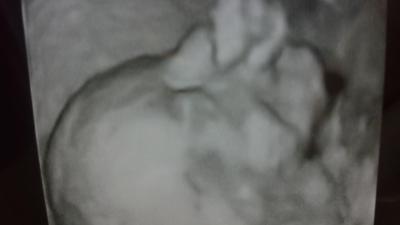 Bild zu Zurück von der Feindiagnostik - Forum für August - Mamis