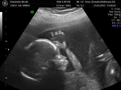 Bild zu Bild - Forum für August - Mamis