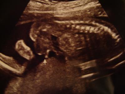 Bild zu Heute FD Termin - Forum für August - Mamis