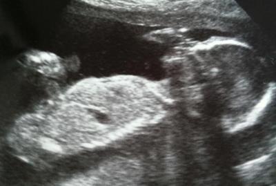 Bild zu Wollte mich mal kurz vorstellen... - Forum für August - Mamis