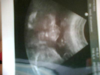 Bild zu zurück vom FA - Forum für August - Mamis