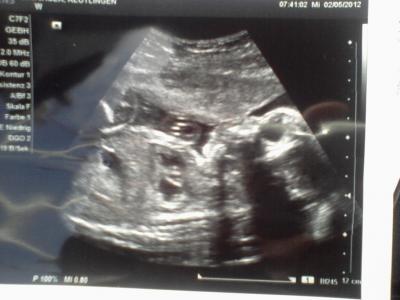 Bild zu Gehts Euch auch immer so???? - Forum für August - Mamis