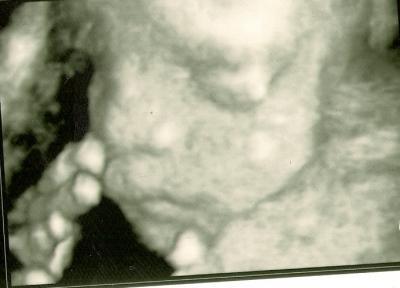 Bild zu Hatte gestern 3D - Forum für August - Mamis