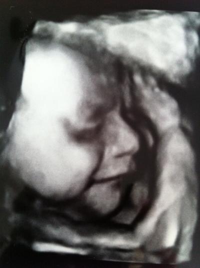 Bild zu Gestern CTG/VU/3D Ultraschall - Forum für August - Mamis