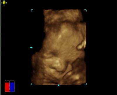 Bild zu unser deutsches durchschnittsbaby... - Forum für August - Mamis