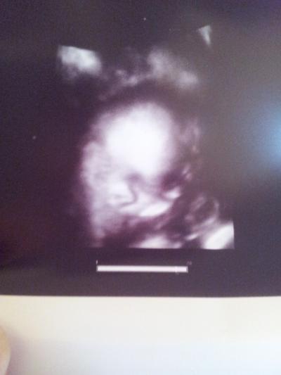 Bild zu zurück vom FA ^^ - Forum für August - Mamis