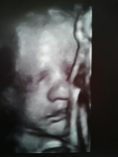 Bild zu 3. Screening ..... - Forum für August - Mamis