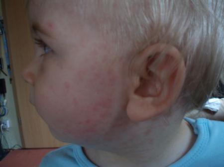 Bild zu 