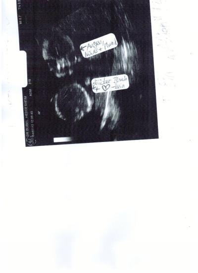Bild zu Ultraschallbild: Erkennt IHR etwas?? - Forum für August - Mamis