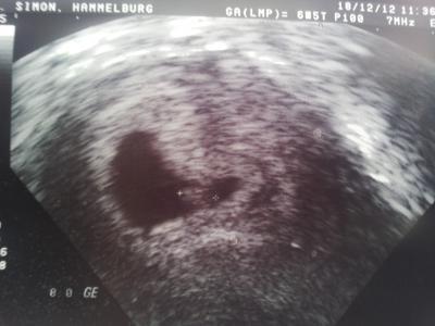 Bild zu ArztBericht mit erstem Bildchen - Forum für August - Mamis