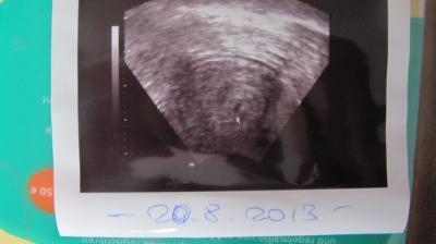 Bild zu Erstes Bildchen - Forum für August - Mamis