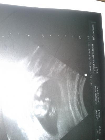 Bild zu So jetzt kommt das Bild - Forum für August - Mamis