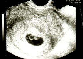 Bild zu Arztbericht - Forum für August - Mamis