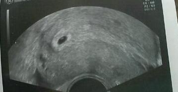 Bild zu Erstes us heute :-) 5+5 wollte es euch zeigen :-) - Forum für August - Mamis