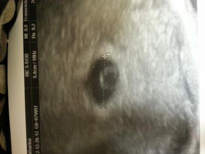 Bild zu Bericht vom kh - Forum für August - Mamis