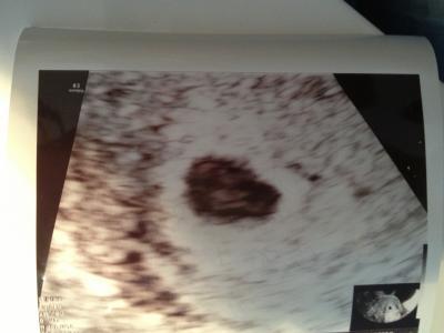 Bild zu US ..... was sieht man bei euch? - Forum für August - Mamis