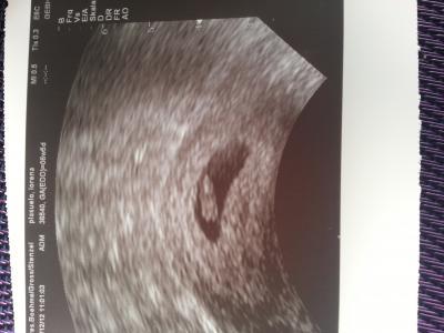 Bild zu zurück vom FA :) - Forum für August - Mamis