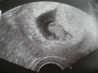 Bild zu Bin auch zurück mit Bild - Forum für August - Mamis