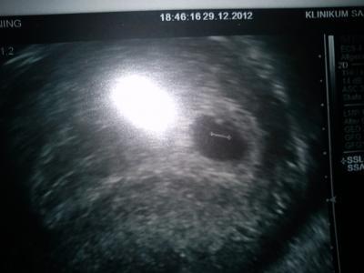 Bild zu Husten halsweh kopfweh und kleiner kh bericht - Forum für August - Mamis