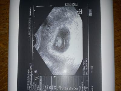 Bild zu Zurück vom FA +Bild - Forum für August - Mamis