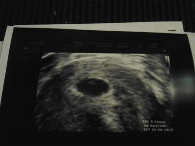 Bild zu :-) fa bericht + foto - Forum für August - Mamis