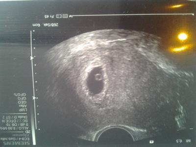 Bild zu gestern schon wieder KH ich mag nicht mehr...+ foto - Forum für August - Mamis