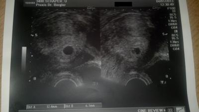 Bild zu Auch ich bin jetzt so richtig dabei! War heute beim FA.... - Forum für August - Mamis