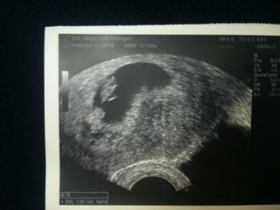 Bild zu Eeeendlich FA Termin - Forum für August - Mamis