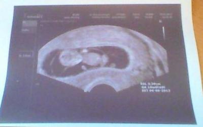 Bild zu FA Bericht + Foto - Forum für August - Mamis