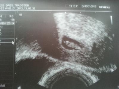 Bild zu baby Bild :)) - Forum für August - Mamis