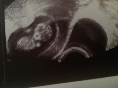 Bild zu Fa-Bericht und glücklich - Forum für August - Mamis