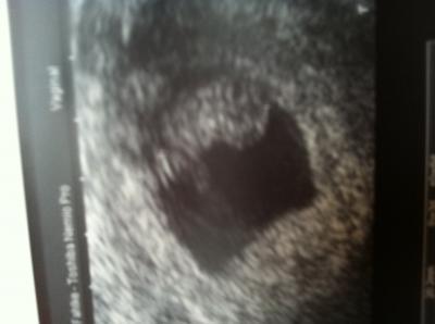 Bild zu Bericht vom FA Termin - Forum für August - Mamis