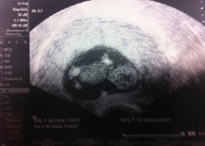 Bild zu Mein Baby - Forum für August - Mamis