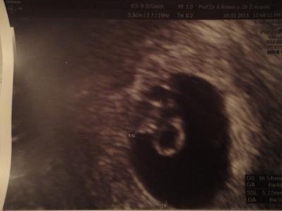 Bild zu Endlich Schwanger! :) - Forum für August - Mamis