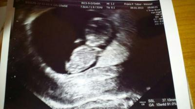 Bild zu wollt Euch mal meinen Puschel zeigen < 3 - Forum für August - Mamis