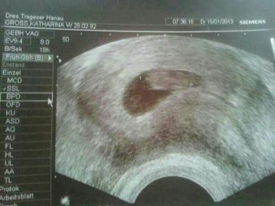 Bild zu FA Termin Bericht! - Forum für August - Mamis