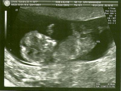 Bild zu Heute Klinik - Forum für August - Mamis